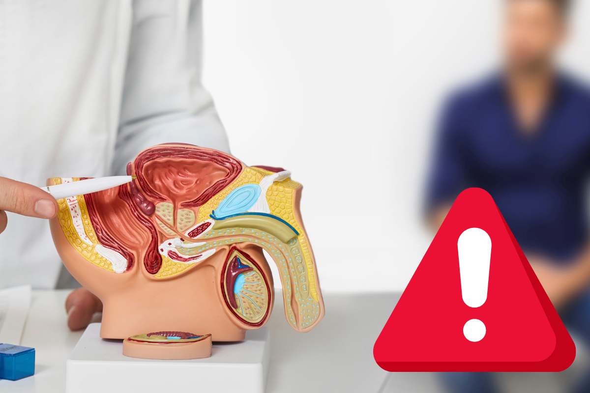 cosa non mangiare cancro prostata
